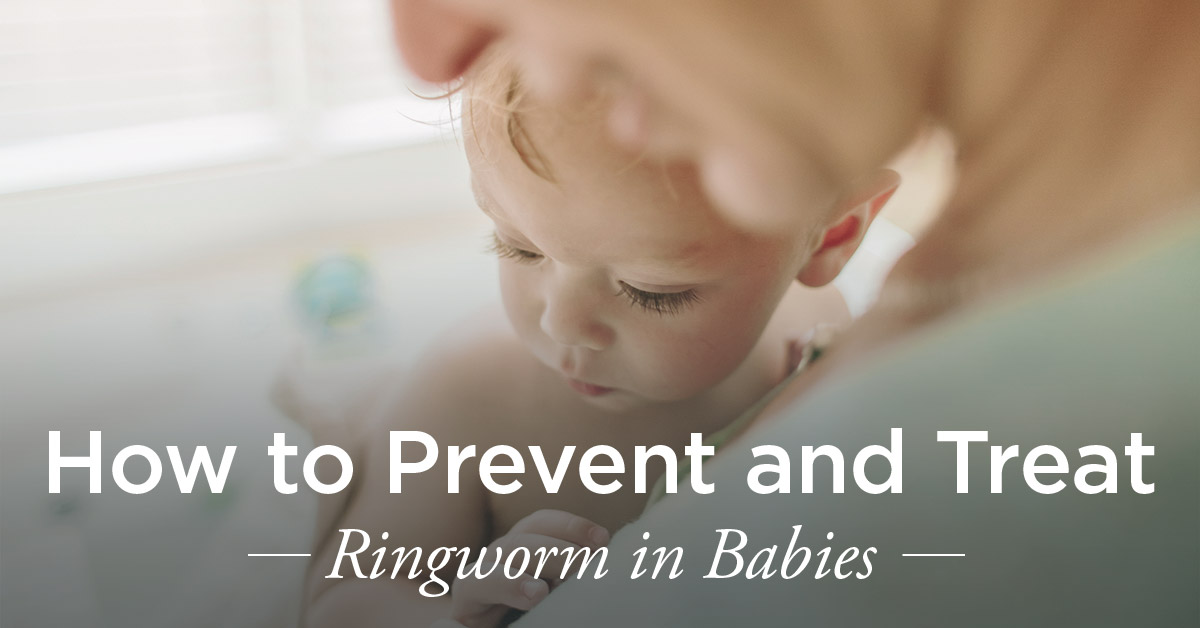 Featured image of post Early Stage Ringworm On Baby